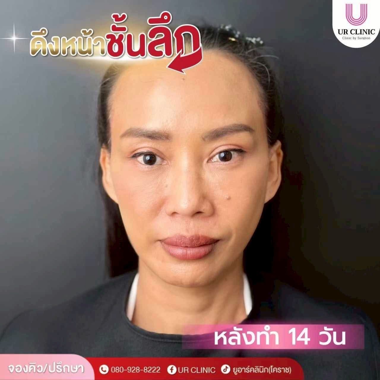 fd51871b 2a99 4d9e 904a 0acc2a351ad9